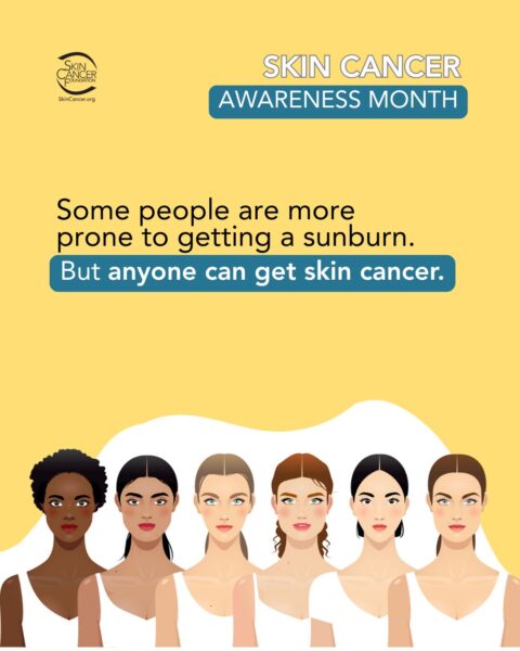 Some people are more prone to sunburn but anyone can get burned