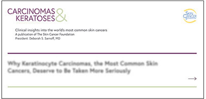 Carcinomas and keratoses Carcinomas and keratoses banner preview