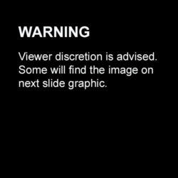 viewer-discretion-2 Warning: Viewer discretion is advised. Some will find the image on the next slide graphic.